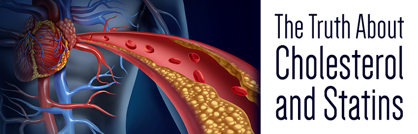Cholesterol